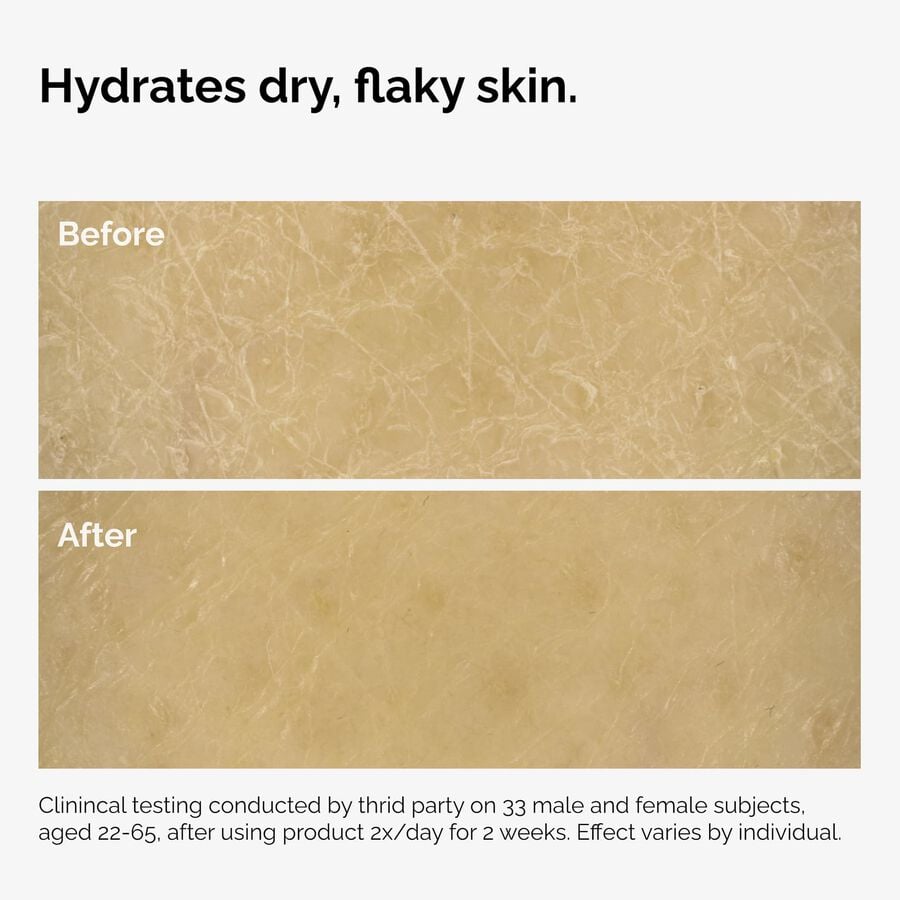the-body-care-collection-c3 ord-natural-moisturizing-factors-inulin-body-before-after-graphic-02.jpg