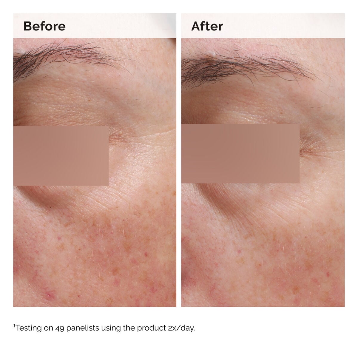 niacinamide-5-face-and-body-emulsion-k8 2024-08-23-ORD-Nia-5pct-Face-Body-B-A-Elasticity-Global-02-1x1.jpg
