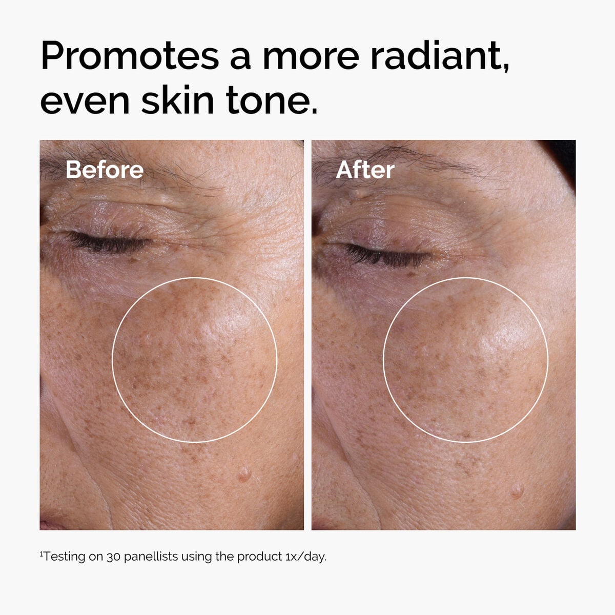 glycolic-acid-7-exfoliating-toner-y4 ord-glycolic-before-after-radiance.jpg