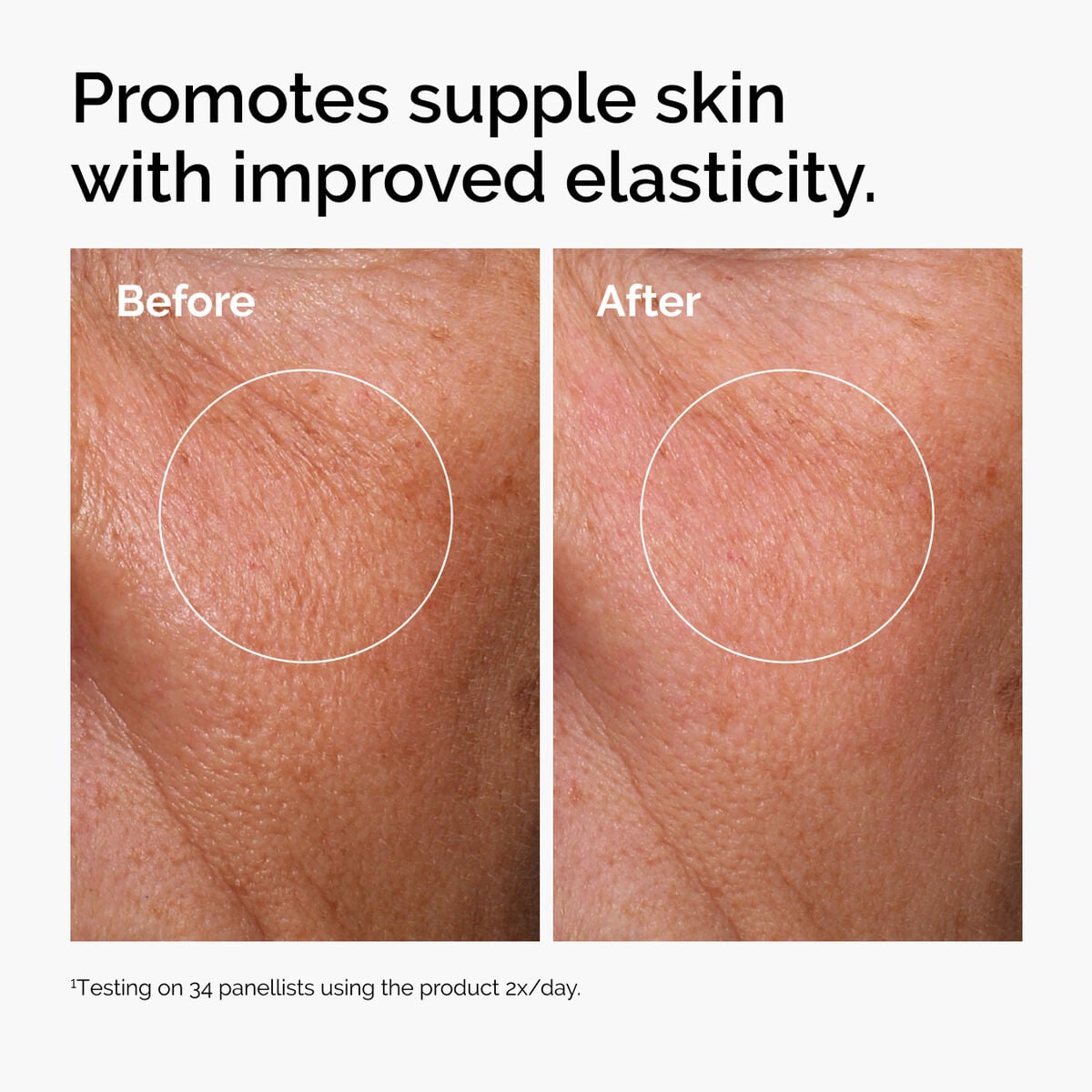 hyaluronic-acid-2-b5-with-ceramides-q2 ord-hyaluronic-acid-2pct-b5-hydrating-serum-before-after-elasticity.jpg