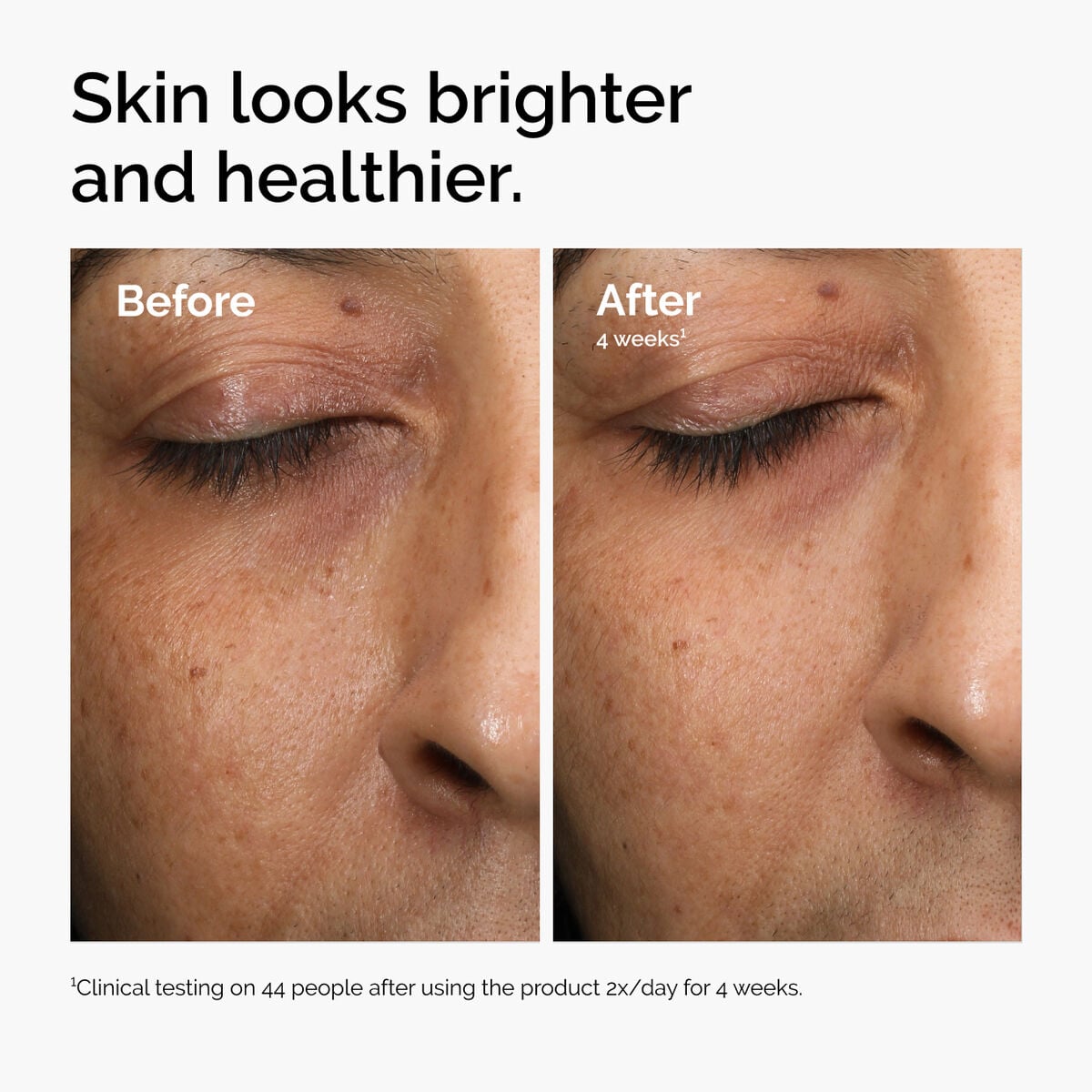 multi-antioxidant-radiance-serum-w2 ord-mars-before-after-healthy.jpg