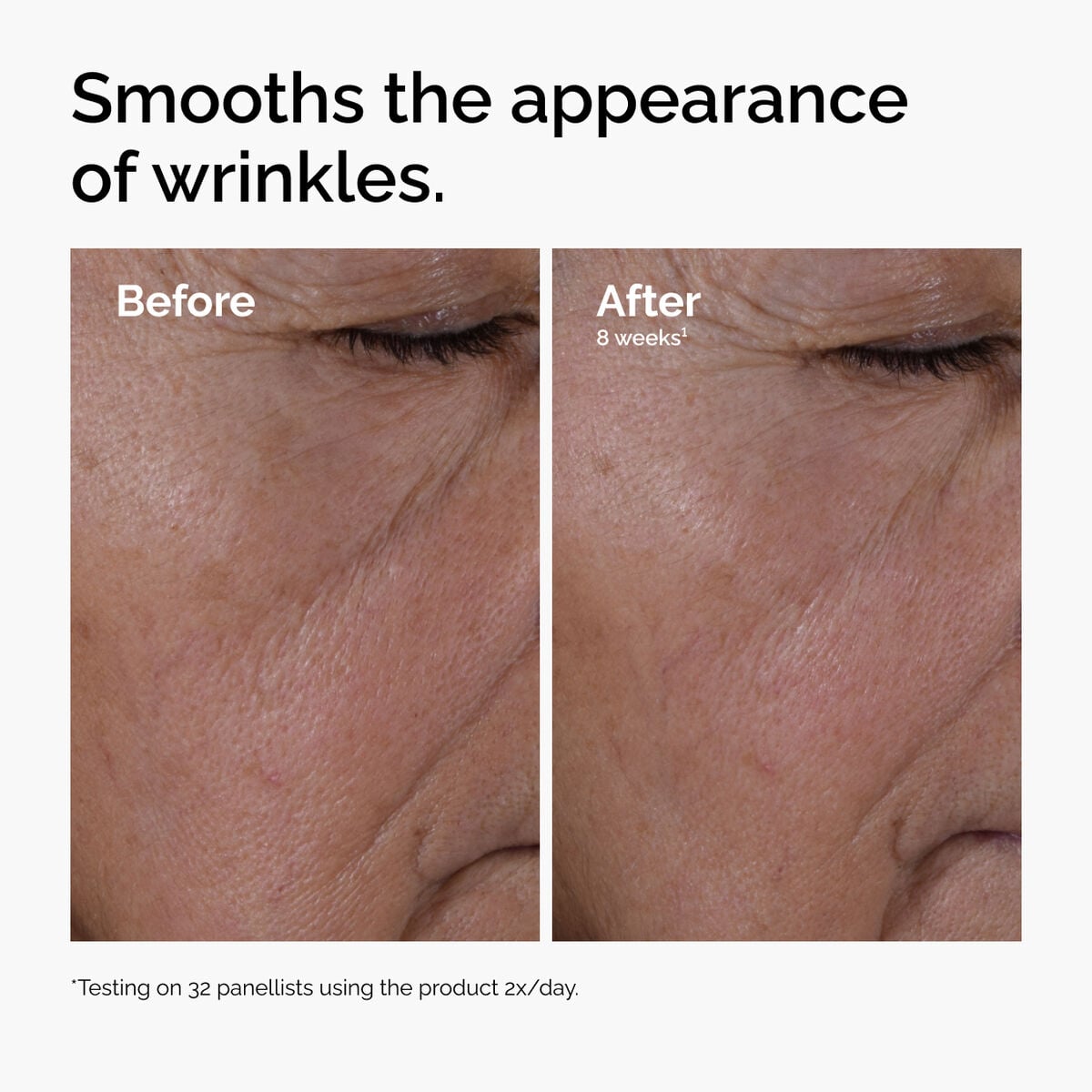 multi-peptide-ha-serum-p4 ord-multi-peptide-ha-serum-wrinkles-before-after.jpg
