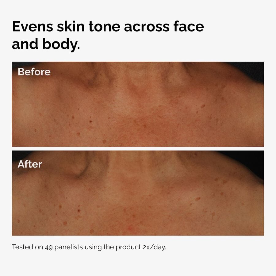 the-body-care-collection-c3 ord-niacinamide-face-body-serum-before-after-even-tone-graphic.jpg
