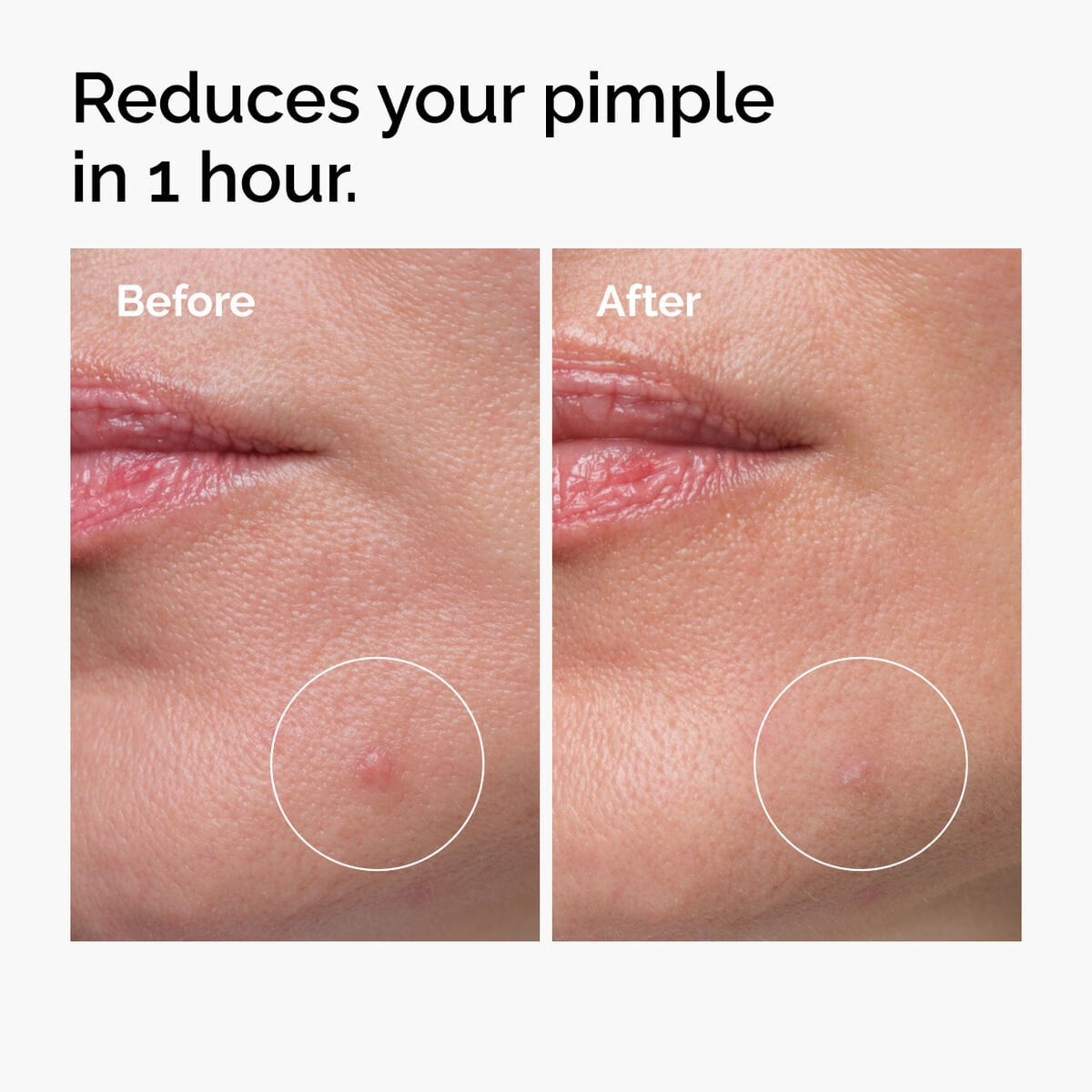 sulfur-10-powder-to-cream-concentrate-k1 ord-sulfur-10pct-powder-to-cream-concentrate-before-after-NA.jpg