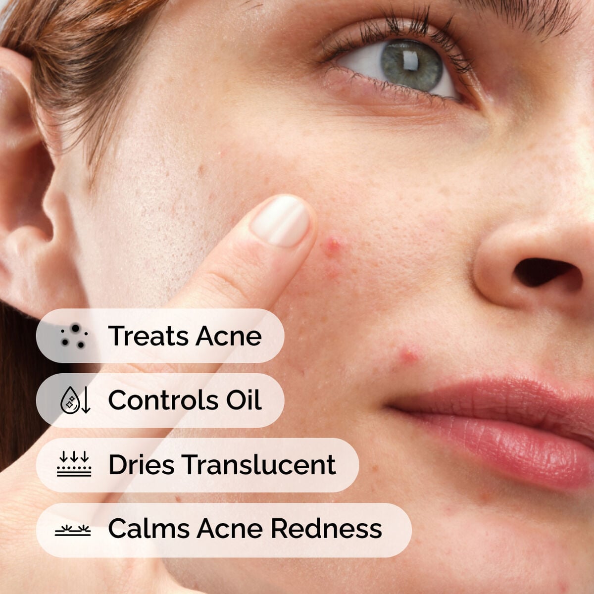 sulfur-10-powder-to-cream-concentrate-k1 ord-sulfur-10pct-powder-to-cream-concentrate-model-application-with-benefits-acne.jpg